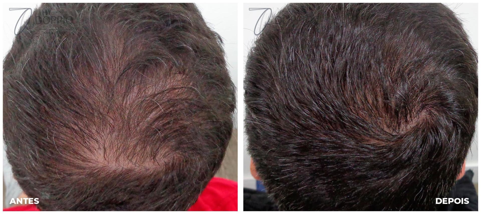Antes e depois 2