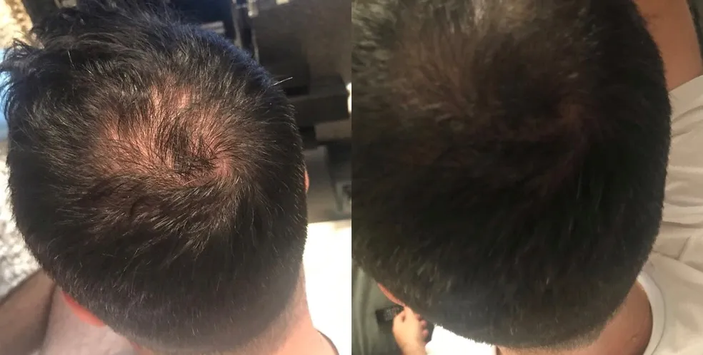 Antes e depois 3