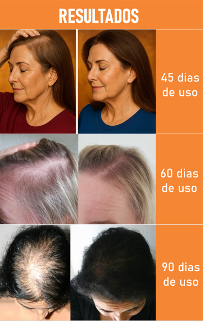 Evolução em 45, 60 e 90 dias